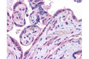 Immunohistochemistry (IHC) image for anti-V-Maf Musculoaponeurotic Fibrosarcoma Oncogene Homolog (Avian) (MAF) (N-Term) antibody (ABIN2780675) (MAF Antikörper  (N-Term))