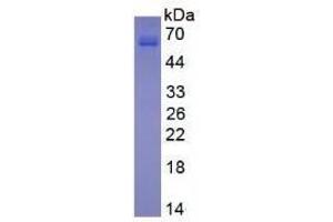 Image no. 1 for Matrix Metallopeptidase 13 (Collagenase 3) (MMP13) (AA 14-466) (Active) protein (His tag) (ABIN6239754)