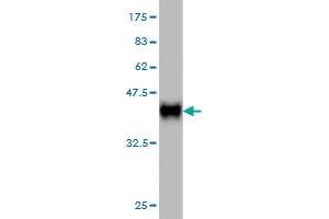 Western Blot detection against Immunogen (36. (UCKL1 Antikörper  (AA 301-400))