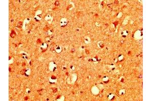 IHC image of ABIN7160478 diluted at 1:400 and staining in paraffin-embedded human brain tissue performed on a Leica BondTM system. (MZF1 Antikörper  (AA 186-354))