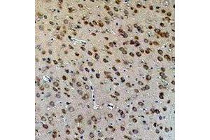 Immunohistochemical analysis of Aquaporin 4 staining in rat brain  formalin fixed paraffin embedded tissue section. (Aquaporin 4 Antikörper)