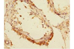 Immunohistochemistry (IHC) image for anti-Core-binding Factor, Runt Domain, alpha Subunit 2, Translocated To, 2 (CBFA2T2) (AA 325-604) antibody (ABIN7165192)