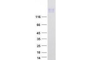 Western Blotting (WB) image for Protein tyrosine Phosphatase, Receptor Type, H (PTPRH) protein (Myc-DYKDDDDK Tag) (ABIN2729818)