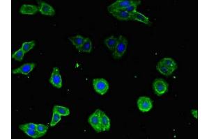 Immunofluorescent analysis of HepG2 cells using ABIN7149146 at dilution of 1:100 and Alexa Fluor 488-congugated AffiniPure Goat Anti-Rabbit IgG(H+L) (COX19 Antikörper  (AA 8-90))