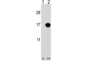 Western Blotting (WB) image for anti-Cyclin-Dependent Kinase Inhibitor 2B (p15, Inhibits CDK4) (CDKN2B) (AA 102-130) antibody (ABIN3030647)