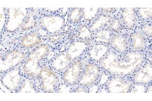 Immunohistochemistry (IHC) image for anti-Insulin-Like Growth Factor Binding Protein 2, 36kDa (IGFBP2) (AA 30-316) antibody (ABIN7430597)