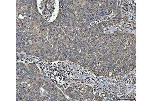 IHC analysis of NDUFV2 using anti-NDUFV2 antibody (ABIN7599154). (NDUFV2 Antikörper  (AA 1-249))