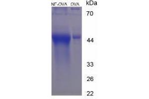Image no. 1 for Noradrenaline protein (Ovalbumin) (ABIN1880121) (Noradrenaline Protein (Ovalbumin))