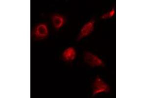 ABIN6274131 staining 293 cells by IF/ICC. (ALX3 Antikörper  (Internal Region))