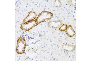 Immunohistochemistry of paraffin-embedded rat kidney using MYO5A antibody (ABIN6003562) at dilution of 1/100 (40x lens). (MYO5A Antikörper)