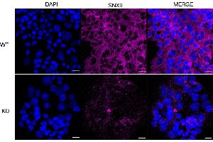 anti-Sorting Nexin 9 (SNX9) antibody