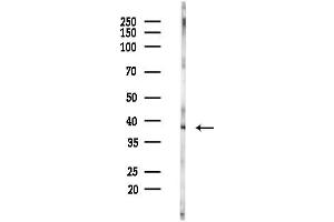anti-GTPase, IMAP Family Member 4 (GIMAP4) (Internal Region) antibody