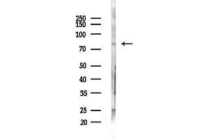 anti-NHL Repeat Containing 2 (NHLRC2) antibody