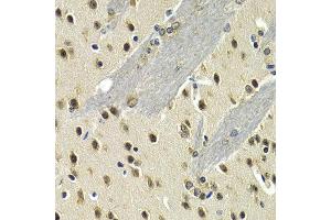 Immunohistochemistry of paraffin-embedded mouse brain using MAX antibody at dilution of 1:200 (400x lens). (MAX Antikörper)