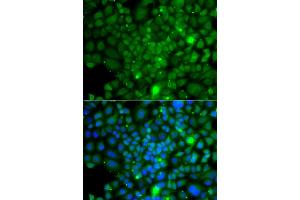 Immunofluorescence analysis of A549 cells using RRAGA antibody (ABIN5974959). (RRAGA Antikörper)