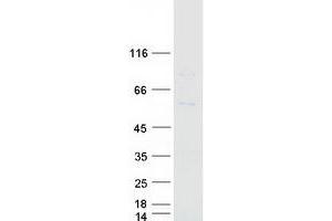 Western Blotting (WB) image for Cytochrome P450, Family 7, Subfamily B, Polypeptide 1 (CYP7B1) protein (Myc-DYKDDDDK Tag) (ABIN2712787)