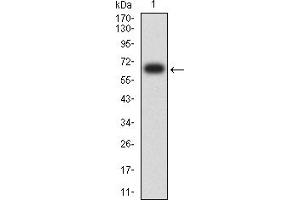 Western blot analysis using KRT13 mAb against human KRT13 (AA: 104-458) recombinant protein. (Cytokeratin 13 Antikörper  (AA 104-458))