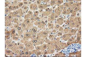 Image no. 1 for anti-Aldolase B, Fructose-Bisphosphate (ALDOB) antibody (ABIN1496606) (ALDOB Antikörper)