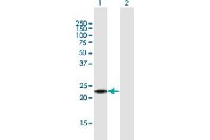 Western Blot analysis of ANKRD7 expression in transfected 293T cell line by ANKRD7 MaxPab polyclonal antibody. (ANKRD7 Antikörper  (AA 1-201))