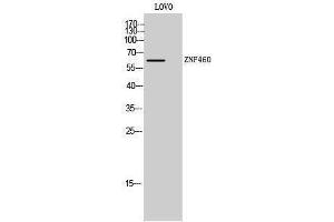 Western Blotting (WB) image for anti-Zinc Finger Protein 460 (ZNF460) (C-Term) antibody (ABIN3178003) (ZNF460 Antikörper  (C-Term))