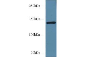 Western Blotting (WB) image for anti-Sema Domain, Immunoglobulin Domain (Ig), Transmembrane Domain (TM) and Short Cytoplasmic Domain, (Semaphorin) 4D (SEMA4D) (AA 502-636) antibody (ABIN7439237)