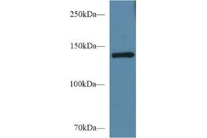 Detection of SEMA4D in Mouse Serum using Polyclonal Antibody to Semaphorin 4D (SEMA4D) (SEMA4D/CD100 Antikörper  (AA 502-636))