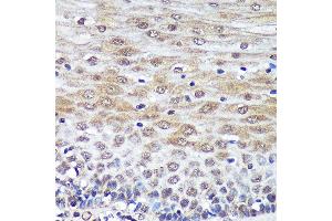 Immunohistochemistry of paraffin-embedded Human esophageal using PSME4 Rabbit pAb  at dilution of 1:100 (40x lens). (PSME4 Antikörper  (AA 1634-1843))