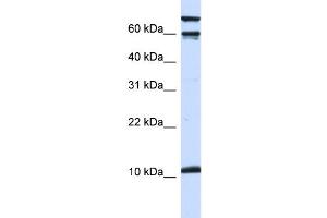 WB Suggested Anti-GAL Antibody Titration:  0. (GAL Antikörper  (Middle Region))