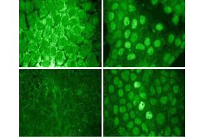A431 cells were serum starved and treated with EGF (100 ng/ml) for 5 minutes, then fixed in 3. (STAT1 Antikörper  (pTyr701))
