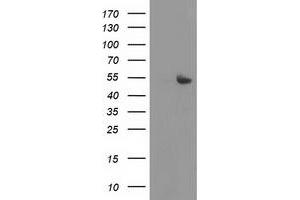 Western Blotting (WB) image for anti-Sedoheptulokinase (SHPK) antibody (ABIN1500920) (SHPK Antikörper)