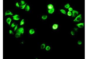 Detection of VIM in MCF7 cells using Polyclonal Antibody to Vimentin (VIM) (Vimentin Antikörper  (AA 2-466))