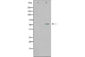 Western blot analysis of extracts from 293 cells, using WASF2 antibody. (WASF2 Antikörper  (Internal Region))