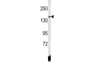 Western Blotting (WB) image for anti-ATPase, Cu++ Transporting, beta Polypeptide (ATP7B) antibody (ABIN3002647) (ATP7B Antikörper)