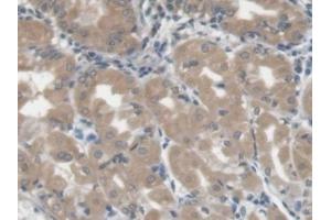 Detection of LGALS3BP in Human Stomach Tissue using Monoclonal Antibody to Lectin Galactoside Binding, Soluble 3 Binding Protein (LGALS3BP) (LGALS3BP Antikörper  (AA 24-221))