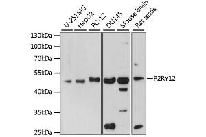 Western blot analysis of extracts of various cell lines, using P2RY12 antibody (ABIN6293326) at 1:1000 dilution.