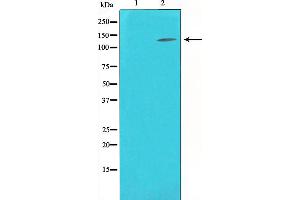 Western blot analysis on K562 cell lysate using eNOS Antibody,The lane on the left is treated with the antigen-specific peptide.