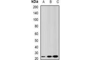 Western blot analysis of GSTA2 expression in mouse liver (A), mouse testis (B), rat kidney (C) whole cell lysates. (GSTa2 Antikörper)