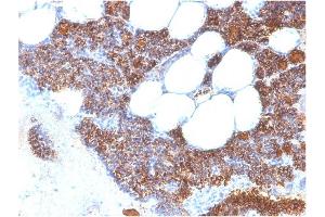 Formalin-fixed, paraffin-embedded human Parathyroid Gland stained with PTH-Monospecific Recombinant Rabbit Monoclonal Antibody (PTH/2295R). (Rekombinanter PTH Antikörper  (AA 32-115))
