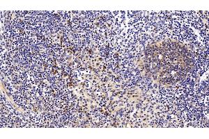 Detection of ANXA1 in Porcine Lymph node Tissue using Polyclonal Antibody to Annexin A1 (ANXA1) (Annexin a1 Antikörper  (AA 208-336))