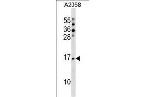 Western blot analysis in A2058 cell line lysates (35ug/lane). (NAT5 Antikörper  (C-Term))