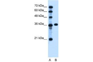 WB Suggested Anti-PTCH1 Antibody Titration:  0.