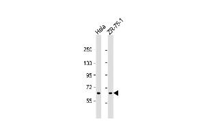All lanes : Anti-TGM5 Antibody (C-term) at 1:1000 dilution Lane 1: Hela whole cell lysate Lane 2: ZR-75-1 whole cell lysate Lysates/proteins at 20 μg per lane. (Transglutaminase 5 Antikörper  (C-Term))