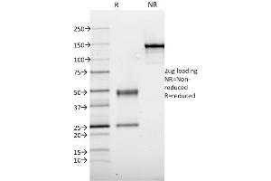 SDS-PAGE Analysis Purified Thyroid Peroxidase Mouse Monoclonal Antibody (TPO/1921). (TPO (AA 685-804) Antikörper)