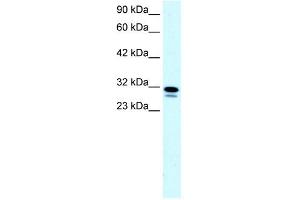 WB Suggested Anti-SSBP2 Antibody Titration: 0. (SSBP2 Antikörper  (N-Term))