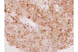 IHC-P Image Immunohistochemical analysis of paraffin-embedded OV90 xenograft, using UGT1A6, antibody at 1:100 dilution.