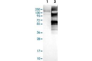Western Blot analysis of Lane 1: negative control (vector only transfected HEK293T cell lysate) and Lane 2: over-expression lysate (co-expressed with a C-terminal myc-DDK tag in mammalian HEK293T cells) with USP20 polyclonal antibody . (USP20 Antikörper)