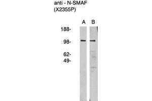 Image no. 1 for anti-Neutral Sphingomyelinase (N-SMase) Activation Associated Factor (NSMAF) antibody (ABIN793717) (NSMAF Antikörper)