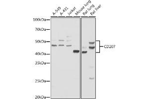 Western blot analysis of extracts of various cell lines, using CD207 antibody (ABIN6131544, ABIN6138141, ABIN6138142 and ABIN6222222) at 1:1000 dilution. (CD207 Antikörper  (AA 69-328))