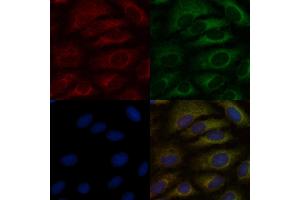 ABIN6265115 and ABIN6276896 staining  cells by IF/ICC. (SLC22A6 Antikörper  (C-Term))