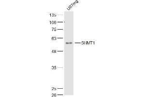 U87MG lysates probed with SHMT1 Polyclonal Antibody, Unconjugated  at 1:300 dilution and 4˚C overnight incubation. (SHMT1 Antikörper  (AA 301-400))